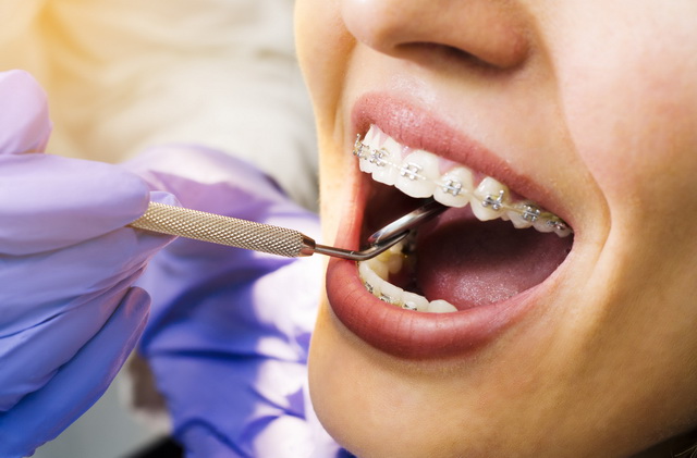 Ортодонтия. Диагностика, лечение и профилактика зубо-челюстных аномалий.