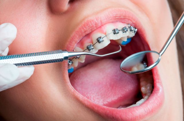 Отдельные вопросы в ортодонтии