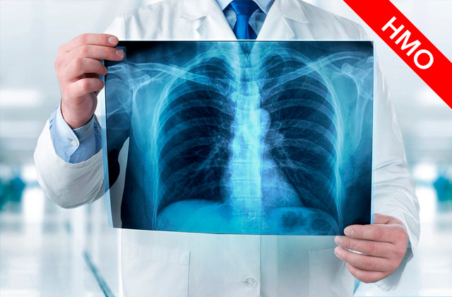 Лучевая диагностика заболеваний органов дыхания (Цикл НМО)